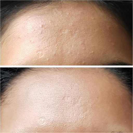 COSRX AHA 7 White Head Power Liquid 100mL (Essence)