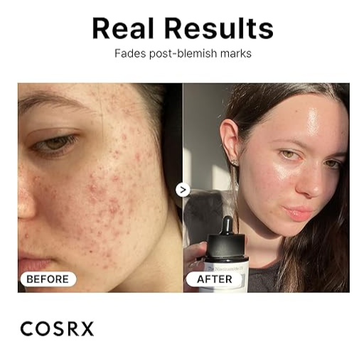 COSRX The Niacinamide 15 Serum 20ml