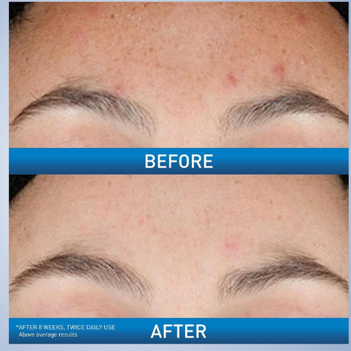 CeraVe Pore Refining, Resurfacing, Brightening Facial Serum (30ml)