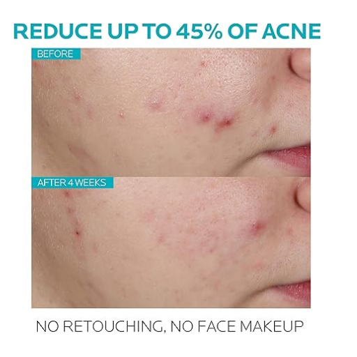 La Roche Posay Effaclar Serum 30ml