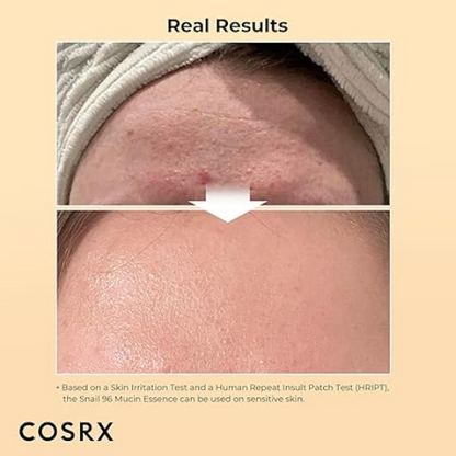 COSRX Advanced Snail 96 Mucin Power Essence (100 ml)